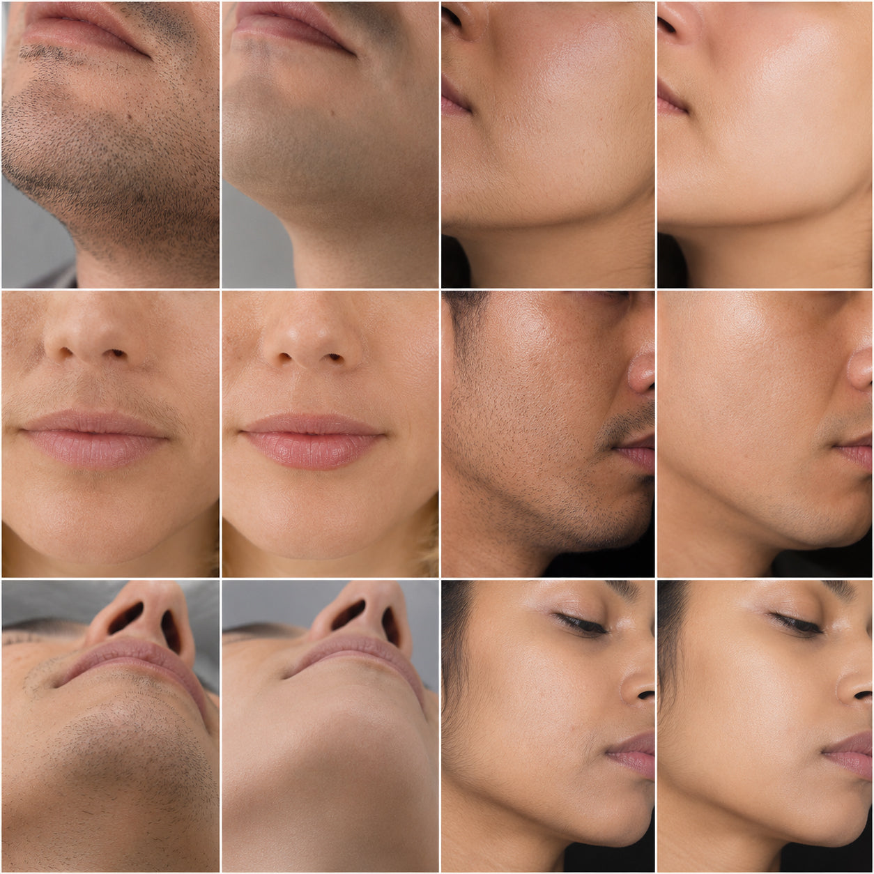Facial hair before and after results