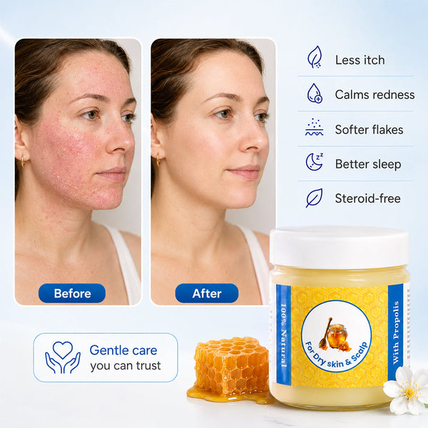 Repair Balm For Eczema & Psoriasis