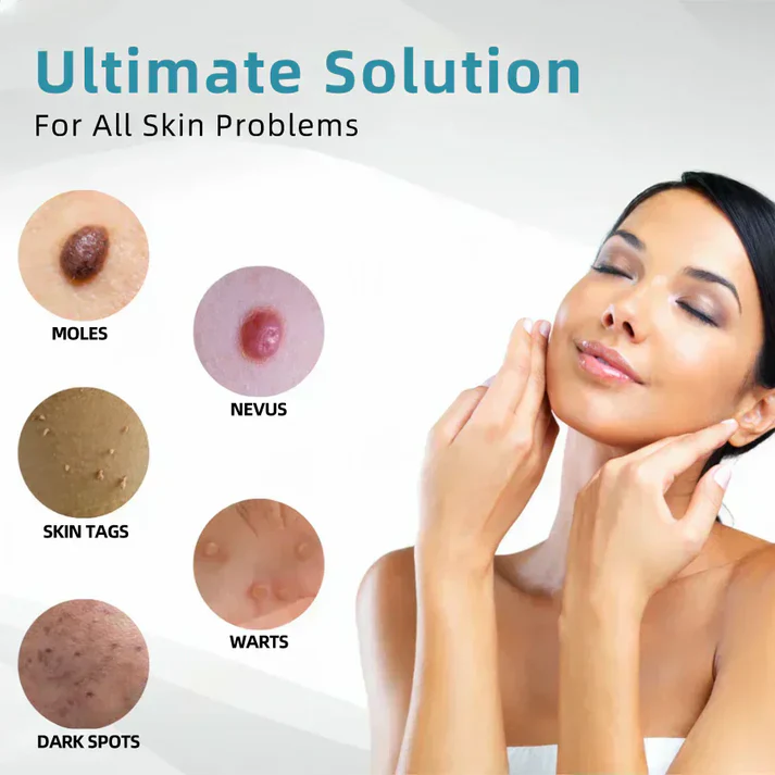 Marssirace All-in-One CO₂ Laser Eraser Pen | Removes Moles, Warts, Skin Flaws & Pigmentation