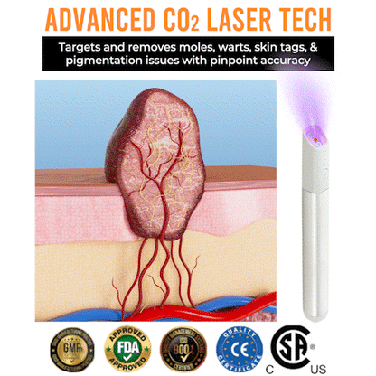 Marssirace All-in-One CO₂ Laser Eraser Pen | Removes Moles, Warts, Skin Flaws & Pigmentation