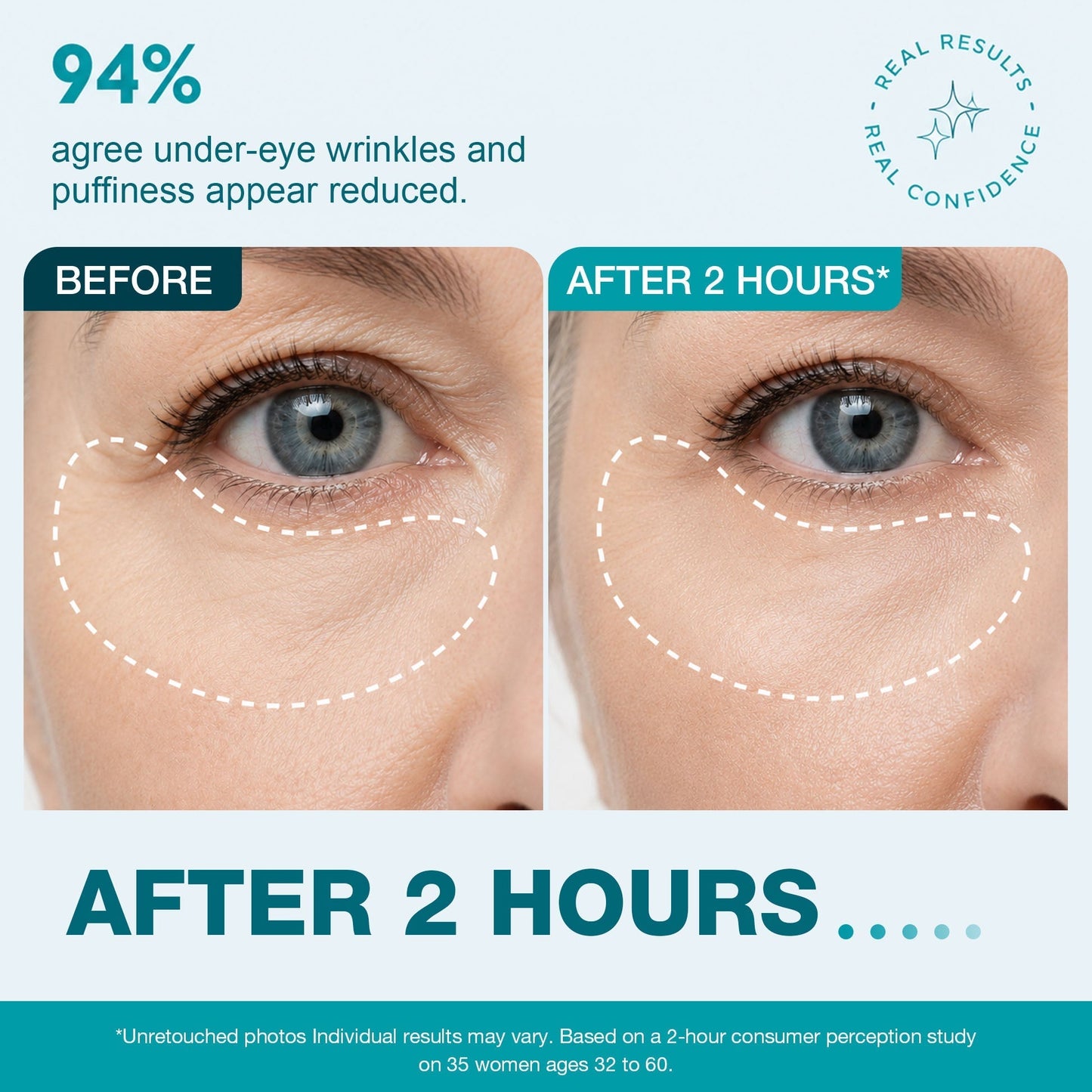 Peptide-Infused Face & Eye Tape