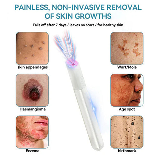 Marssirace All-in-One CO₂ Laser Eraser Pen | Removes Moles, Warts, Skin Flaws & Pigmentation
