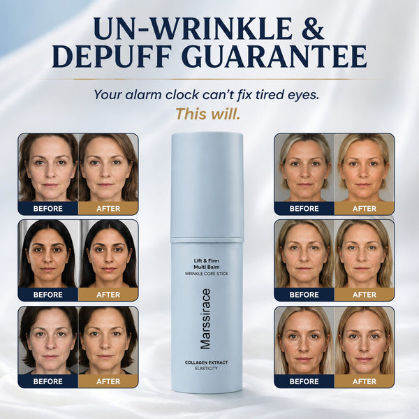 Marssirace - Korean Under Eye Balm