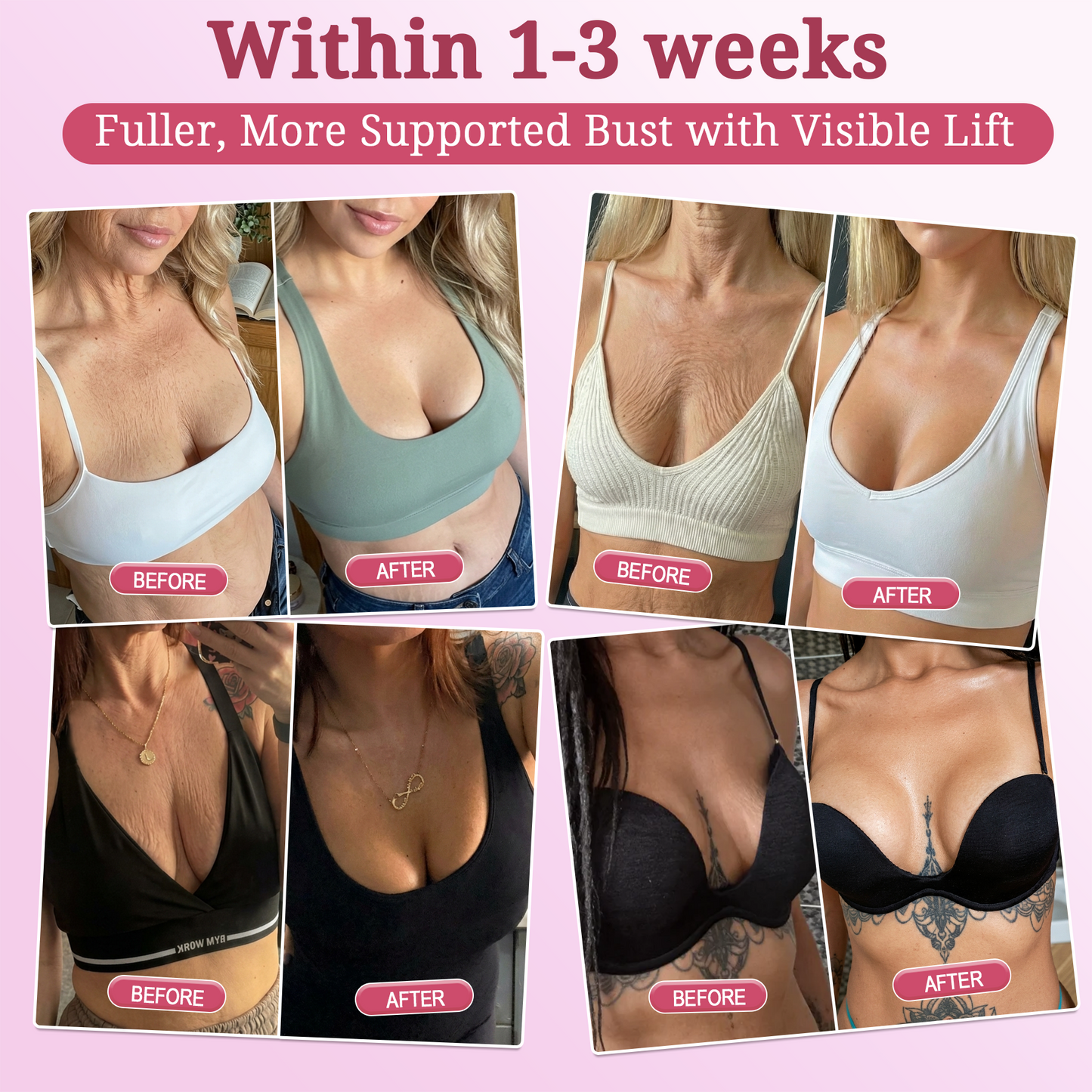 𝐏𝐢𝐧𝐤 𝐂𝐨𝐥𝐥𝐚𝐠𝐞𝐧 𝐒𝐭𝐞𝐦𝐋𝐢𝐟𝐭 𝐏𝐥𝐮𝐦𝐩𝐢𝐧𝐠 𝐌𝐮𝐥𝐭𝐢 𝐁𝐚𝐥𝐦 𝐟𝐨𝐫 𝐔𝐧𝐝𝐞𝐫-𝐄𝐲𝐞𝐬, 𝐍𝐞𝐜𝐤, 𝐅𝐨𝐫𝐞𝐡𝐞𝐚𝐝, 𝐒𝐦𝐢𝐥𝐞 𝐋𝐢𝐧𝐞𝐬,𝐅𝐢𝐫𝐦𝐢𝐧𝐠, 𝐋𝐢𝐟𝐭𝐢𝐧𝐠, 𝐅𝐮𝐥𝐥𝐞𝐫-𝐋𝐨𝐨𝐤𝐢𝐧𝐠 𝐂𝐮𝐫𝐯𝐞𝐬 & 𝐒𝐤𝐢𝐧 𝐂𝐨𝐦𝐟𝐨𝐫𝐭