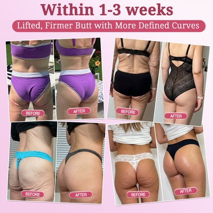 𝐏𝐢𝐧𝐤 𝐂𝐨𝐥𝐥𝐚𝐠𝐞𝐧 𝐒𝐭𝐞𝐦𝐋𝐢𝐟𝐭 𝐏𝐥𝐮𝐦𝐩𝐢𝐧𝐠 𝐌𝐮𝐥𝐭𝐢 𝐁𝐚𝐥𝐦 𝐟𝐨𝐫 𝐔𝐧𝐝𝐞𝐫-𝐄𝐲𝐞𝐬, 𝐍𝐞𝐜𝐤, 𝐅𝐨𝐫𝐞𝐡𝐞𝐚𝐝, 𝐒𝐦𝐢𝐥𝐞 𝐋𝐢𝐧𝐞𝐬,𝐅𝐢𝐫𝐦𝐢𝐧𝐠, 𝐋𝐢𝐟𝐭𝐢𝐧𝐠, 𝐅𝐮𝐥𝐥𝐞𝐫-𝐋𝐨𝐨𝐤𝐢𝐧𝐠 𝐂𝐮𝐫𝐯𝐞𝐬 & 𝐒𝐤𝐢𝐧 𝐂𝐨𝐦𝐟𝐨𝐫𝐭