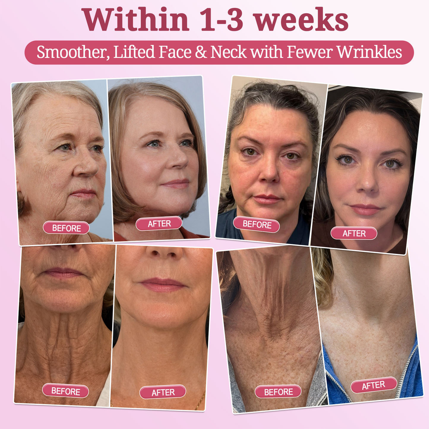 𝐏𝐢𝐧𝐤 𝐂𝐨𝐥𝐥𝐚𝐠𝐞𝐧 𝐒𝐭𝐞𝐦𝐋𝐢𝐟𝐭 𝐏𝐥𝐮𝐦𝐩𝐢𝐧𝐠 𝐌𝐮𝐥𝐭𝐢 𝐁𝐚𝐥𝐦 𝐟𝐨𝐫 𝐔𝐧𝐝𝐞𝐫-𝐄𝐲𝐞𝐬, 𝐍𝐞𝐜𝐤, 𝐅𝐨𝐫𝐞𝐡𝐞𝐚𝐝, 𝐒𝐦𝐢𝐥𝐞 𝐋𝐢𝐧𝐞𝐬,𝐅𝐢𝐫𝐦𝐢𝐧𝐠, 𝐋𝐢𝐟𝐭𝐢𝐧𝐠, 𝐅𝐮𝐥𝐥𝐞𝐫-𝐋𝐨𝐨𝐤𝐢𝐧𝐠 𝐂𝐮𝐫𝐯𝐞𝐬 & 𝐒𝐤𝐢𝐧 𝐂𝐨𝐦𝐟𝐨𝐫𝐭