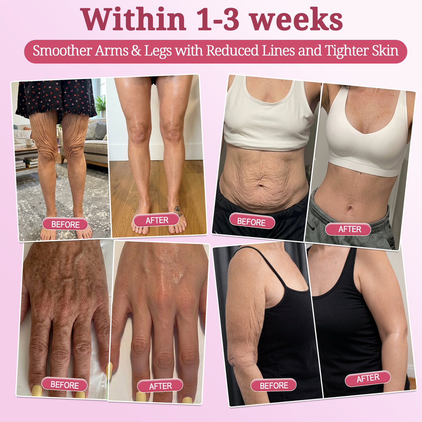 𝐏𝐢𝐧𝐤 𝐂𝐨𝐥𝐥𝐚𝐠𝐞𝐧 𝐒𝐭𝐞𝐦𝐋𝐢𝐟𝐭 𝐏𝐥𝐮𝐦𝐩𝐢𝐧𝐠 𝐌𝐮𝐥𝐭𝐢 𝐁𝐚𝐥𝐦 𝐟𝐨𝐫 𝐔𝐧𝐝𝐞𝐫-𝐄𝐲𝐞𝐬, 𝐍𝐞𝐜𝐤, 𝐅𝐨𝐫𝐞𝐡𝐞𝐚𝐝, 𝐒𝐦𝐢𝐥𝐞 𝐋𝐢𝐧𝐞𝐬,𝐅𝐢𝐫𝐦𝐢𝐧𝐠, 𝐋𝐢𝐟𝐭𝐢𝐧𝐠, 𝐅𝐮𝐥𝐥𝐞𝐫-𝐋𝐨𝐨𝐤𝐢𝐧𝐠 𝐂𝐮𝐫𝐯𝐞𝐬 & 𝐒𝐤𝐢𝐧 𝐂𝐨𝐦𝐟𝐨𝐫𝐭