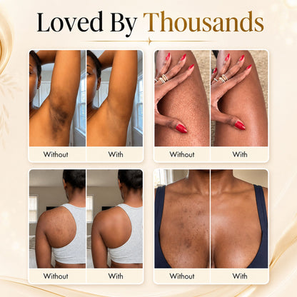 marssirace™ Body Coverage Perfector Set