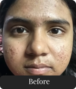 Before treatment