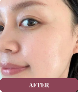 After treatment
