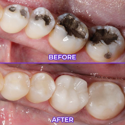 SensiGum Fluoride Toothpaste