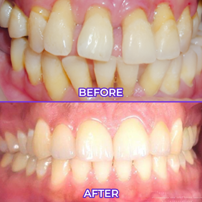 SensiGum Fluoride Toothpaste