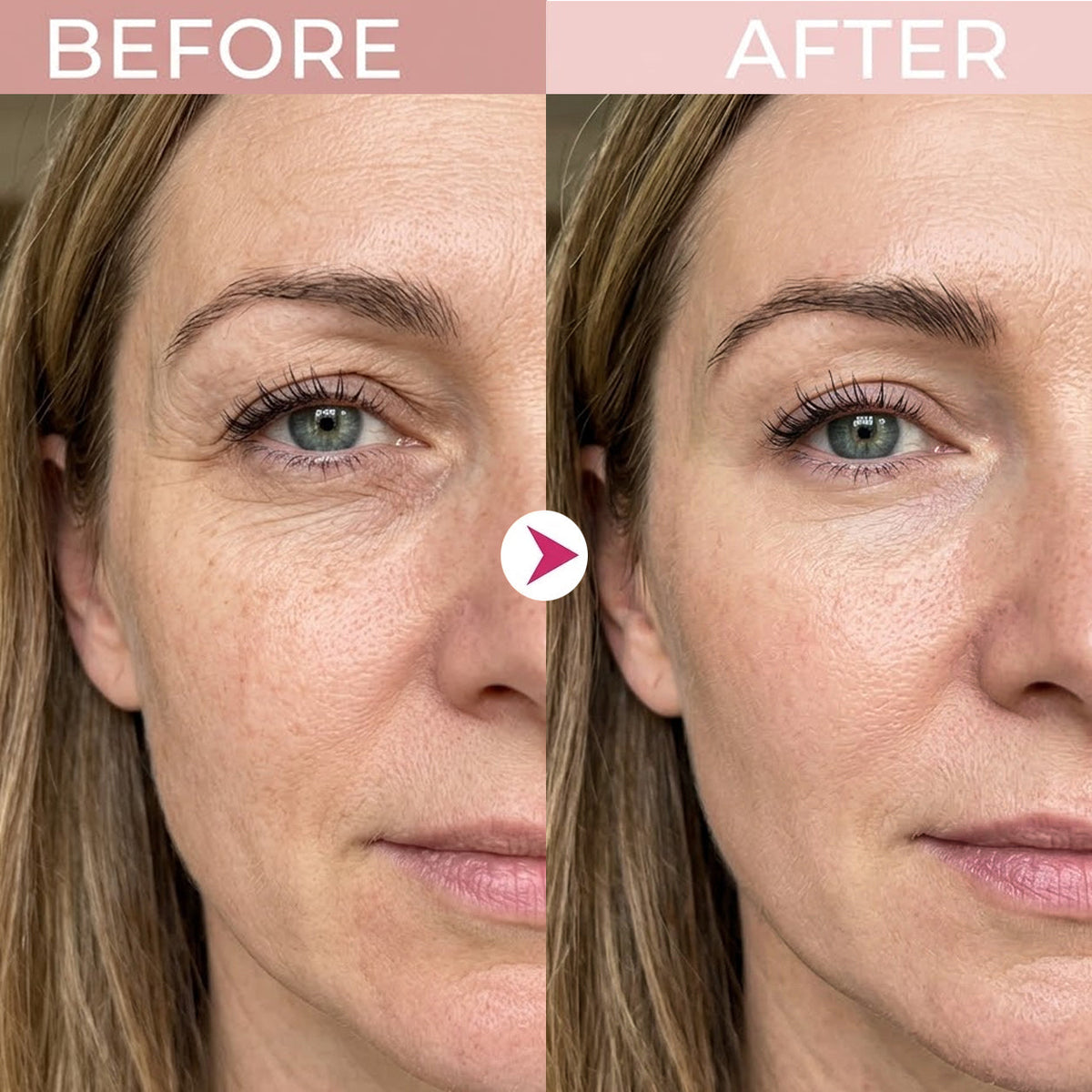 Eye area appearance comparison