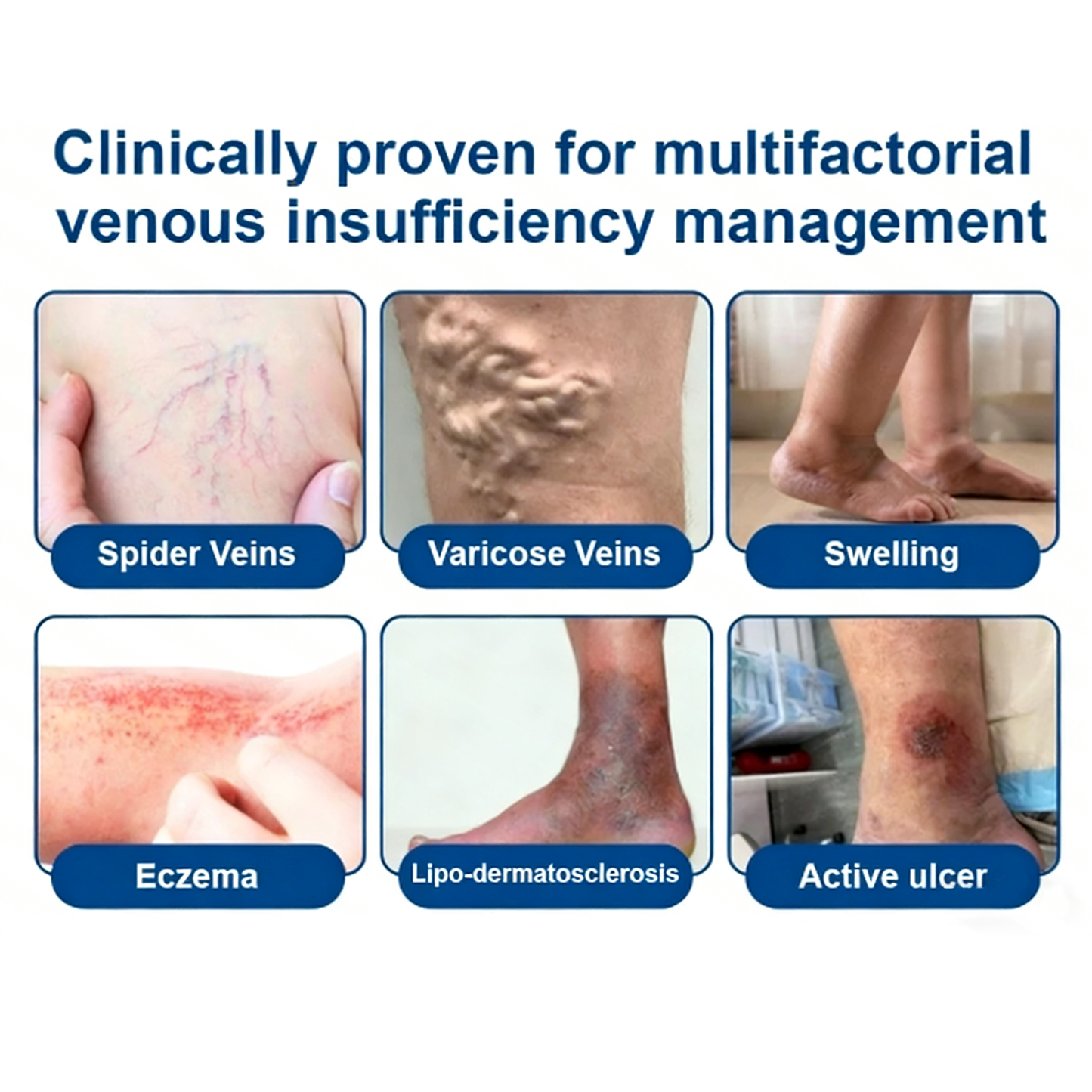 Vein ContourMicroneedle Patch with AdvancedDiosmin & Hesperidin Delivery 🌿 7-Day Visible Results for VaricoseVeins