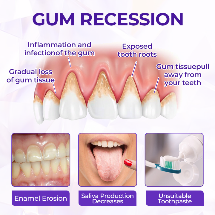 SensiGum Fluoride Toothpaste