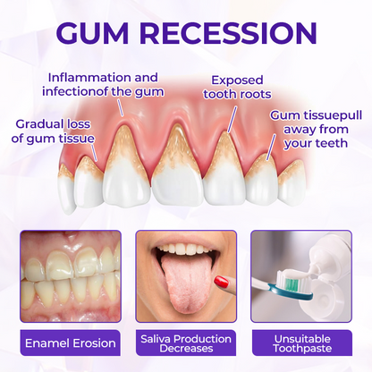 SensiGum Fluoride Toothpaste
