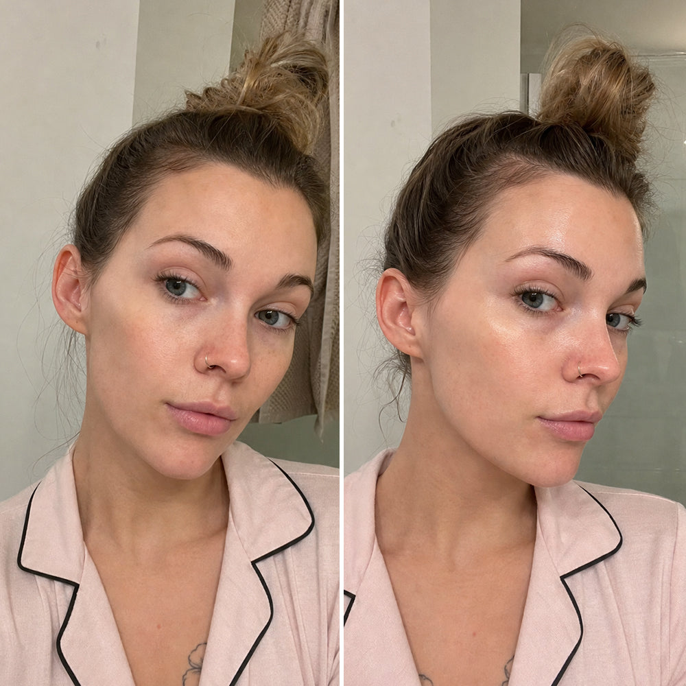 Before and after skin results