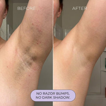Maissirace Hair Removal Mousse