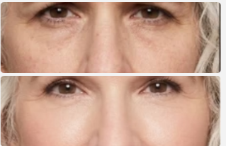 Snipaste_2026-10-14_15-35-02.png