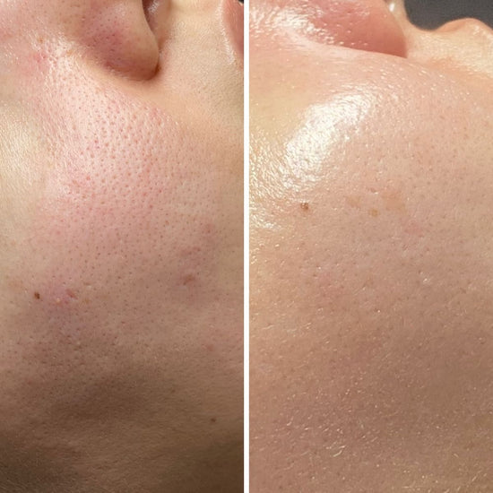 Customer facial skin results