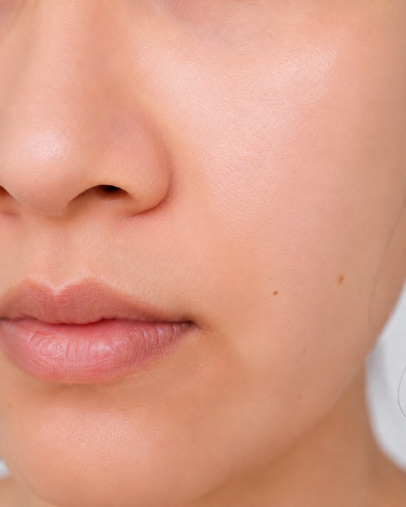Skin after using exfoliating pad