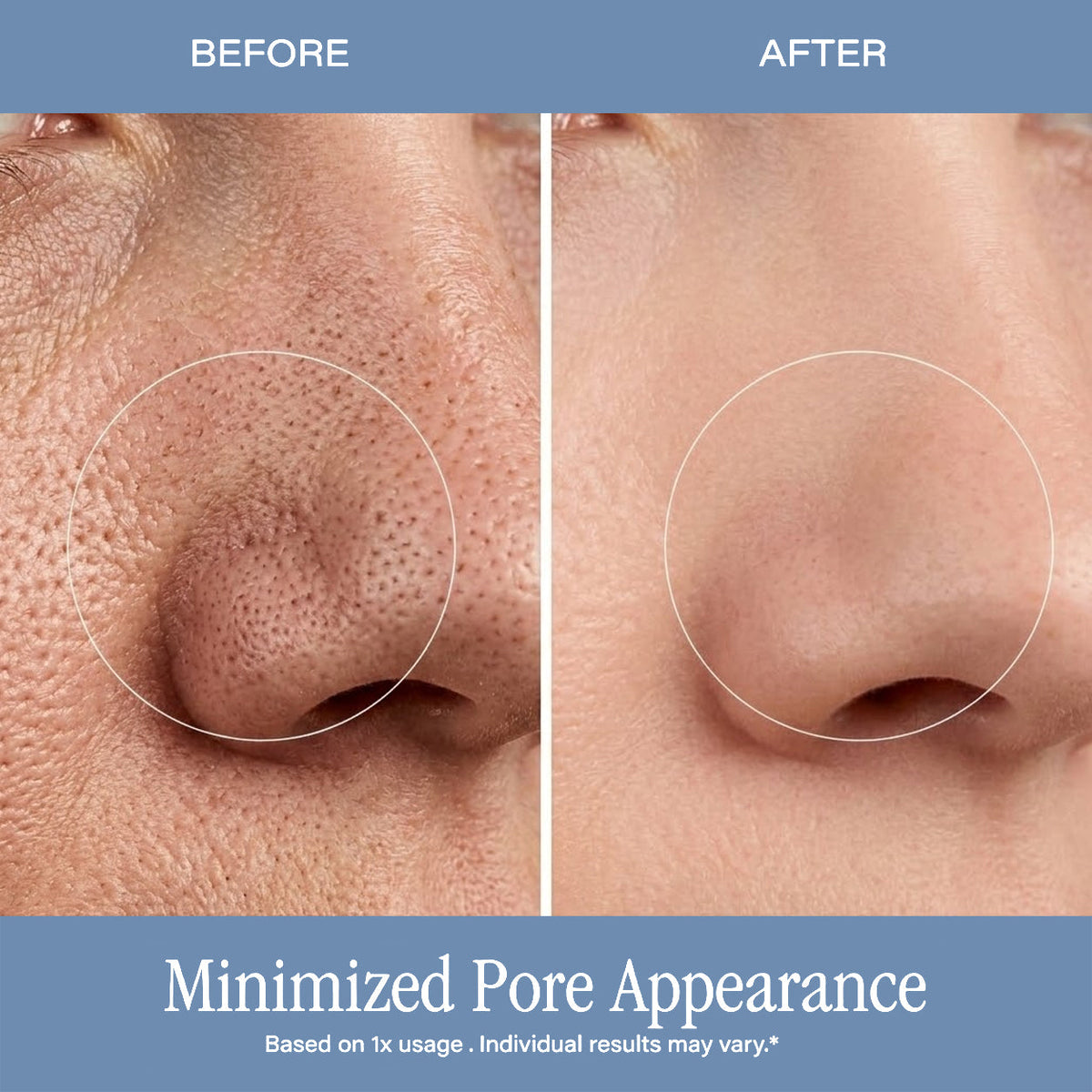 Microdermabrasion Treatment w/ V5 Crystal Technology Facial Exfoliate