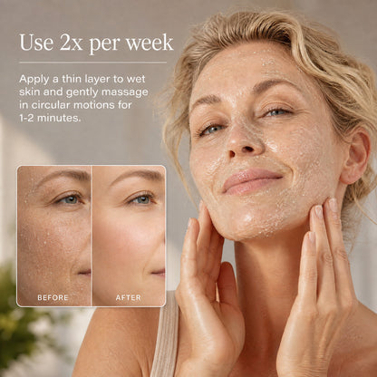 Microdermabrasion Treatment w/ V5 Crystal Technology Facial Exfoliate