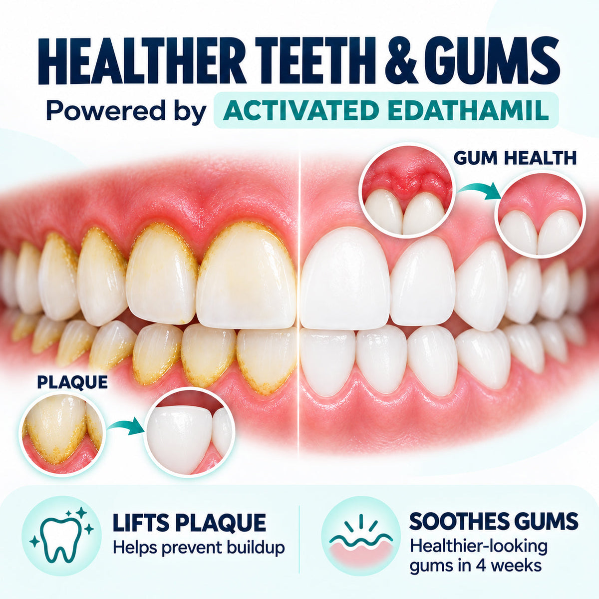 Wintergreen Gel Toothpaste