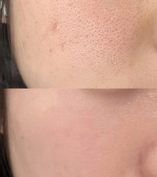 Customer skin results