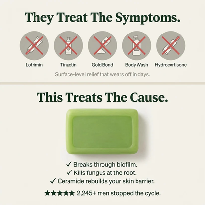 Tea Tree Antifungal Bar – Clears Fungal Infection and Skin Balance from the Root
