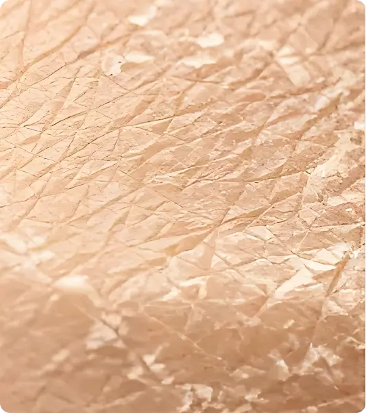 Dull rough skin