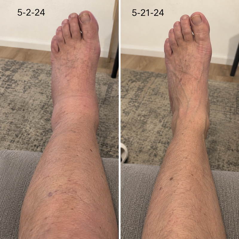 using Marssirace less than 8 weeks