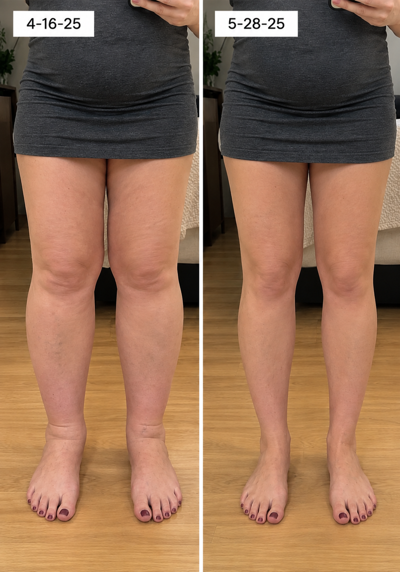 using Marssirace less than 8 weeks