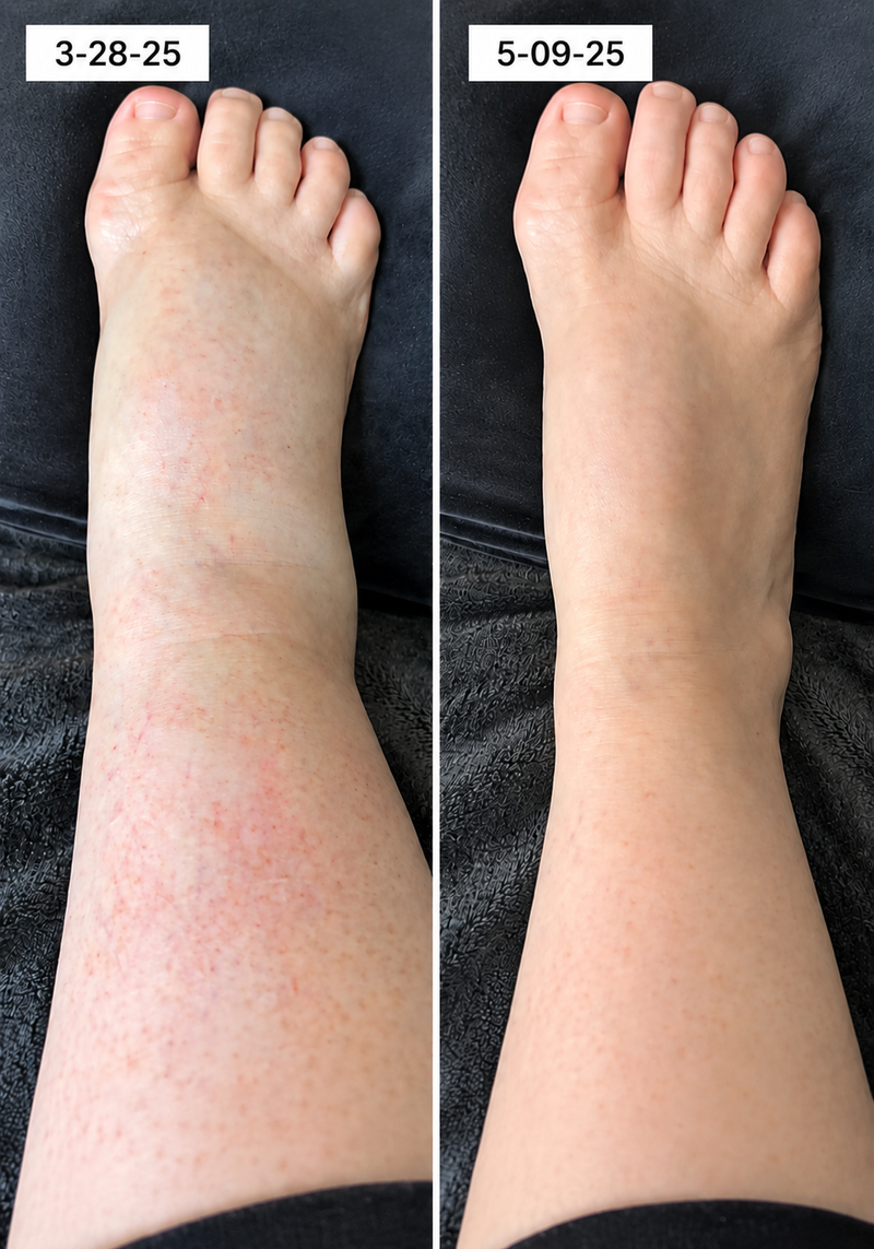 using Marssirace less than 8 weeks